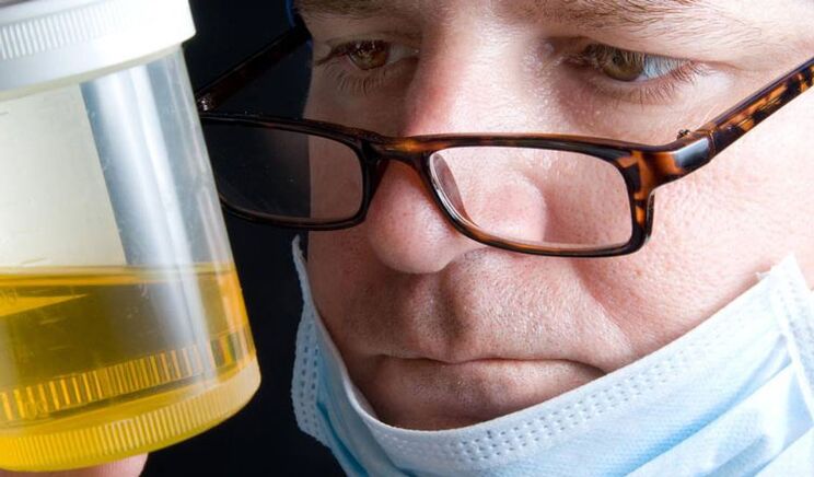 Urinanalyse fir chronesch Prostatitis